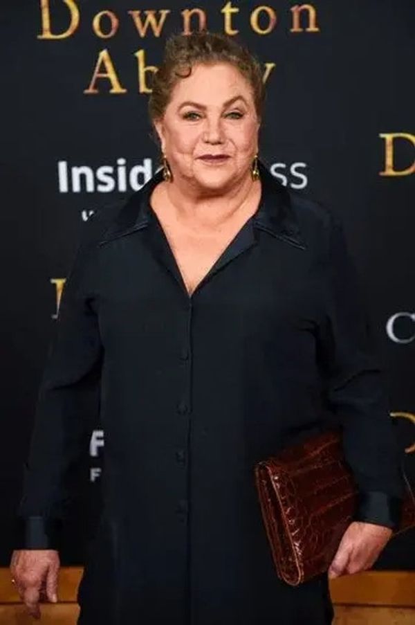 Hollywood Beauty Transformed: The Journey of Kathleen Turner