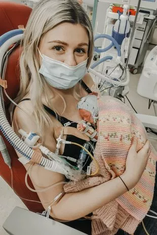 The Power of a Mother’s Love: Saving My Premature Baby Through Cuddles