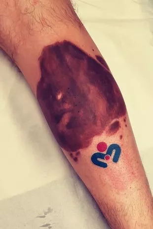 A Father’s Love Knows No Limits: Tattooing His Daughter’s Birthmark