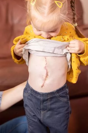 Girl Born with Organs Outside of Body Defies the Odds and Lives a Normal Life