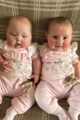 Twin Sisters’ Special Bond Helps Little Girl With Down’s Syndrome Take First Steps