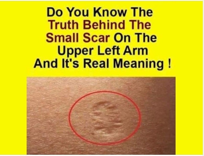 The Story Behind Your Smallpox Scar