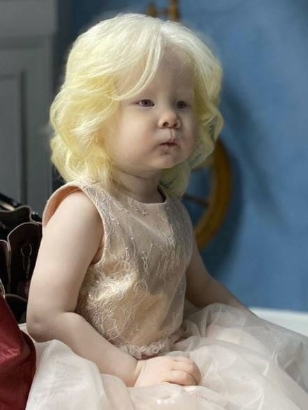 Celebrating the Beauty of Albinism: Asel and Kamila’s Inspiring Journey