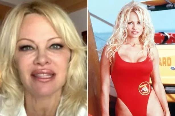 The Timeless Beauty and Inspiring Journey of Pamela Anderson