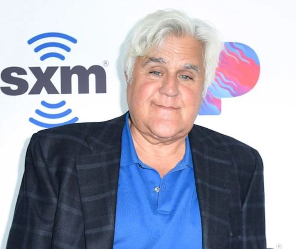 Jay Leno's Burn Incident