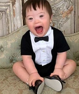 Proud Dad’s Joy as Two-Year-Old with Down’s Syndrome Inspires Others