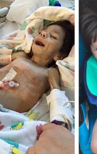 A Heartwarming Journey: Mom Adopts Skeletal 7-Year-Old Orphan Near Death