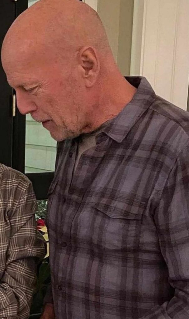 Bruce Willis Battling with Memory Loss and Speech Difficulties