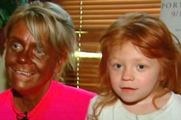 Patricia Krentcil Tanned Five Days a Week, Nearly Facing a Life-Threatening Situation – Here's the Current Appearance of 'Tan Mom