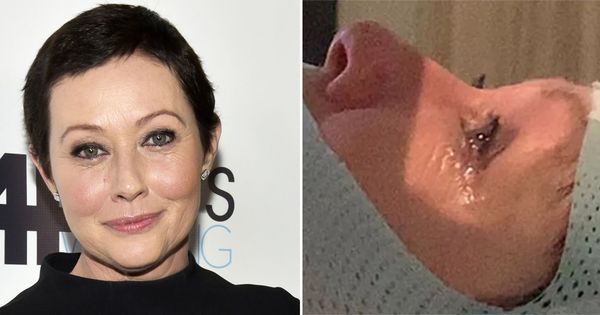 Shannen Doherty’s Courageous Cancer Battle Continues