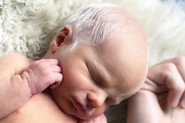 Baby Mocked For Having White Hair – But Wait Until You See How He Looks Years Later