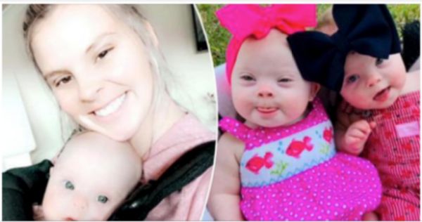 Embracing the Beauty of Rare Down Syndrome Twins