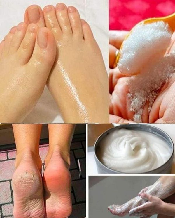 How to Do a Baking Soda Pedicure at Home