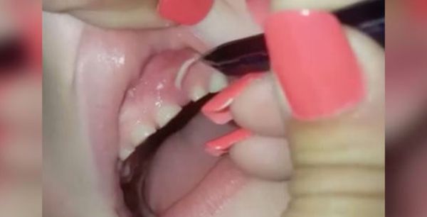 Her Son Complains About A Pain In His Gums. Mom Discovers the Surprising Cause