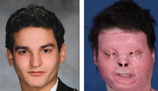 A Life-Changing Surgery: From Tragic Accident to Hopeful Future