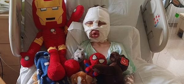 Six-Year-Old Boy Faces Devastating Aftermath of Cruel Prank