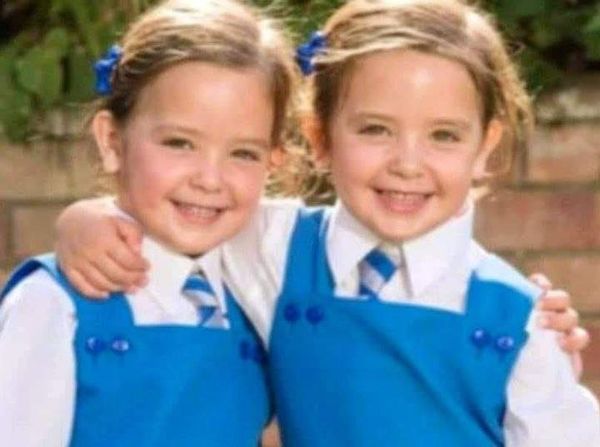 Twins Conjoined at Birth Set to Start School