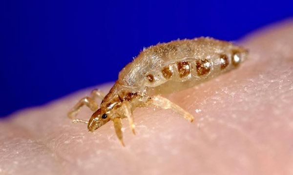 Lice 101: Expert Advice to Bust the Myths and Get Rid of Lice