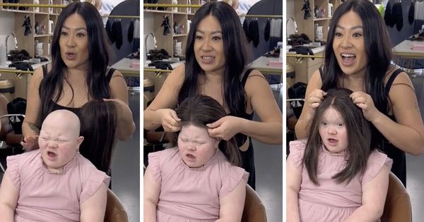 Girl with Alopecia Receives First Wig: A Heartwarming Journey of Empowerment and Self-Acceptance