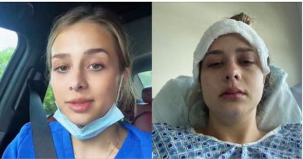 24-Year-Old Diagnosed With Stage 3 Cancer After She Overlooked Continuous Burping