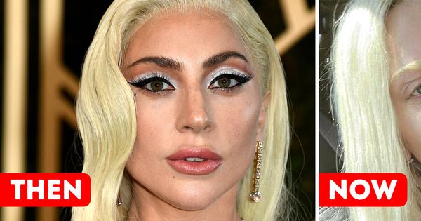 Lady Gaga’s Stunning Transformation