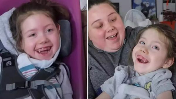 Girl, 8, left permanently paralysed after being kissed when she was just two days old