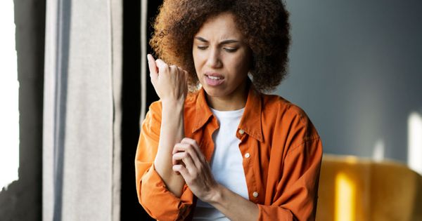 Multi-ethnic woman scratches her reddened hand due to itching. Allergy symptom, healthcare concept. Itchy skin can be caused by dermatitis, eczema, dry skin, burns, allergy, insect bites.