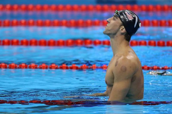 Michael Phelps with cupping therapy bruises