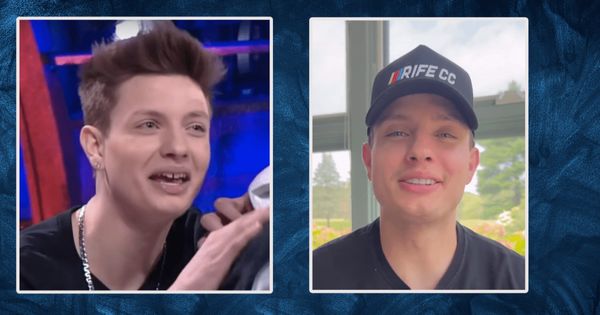 Plastic Surgeon Estimates Matt Rife Has Spent $10,000 on Cosmetic Procedures