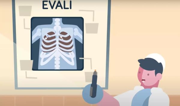 A simulation has depicted the impact of vaping on the body, including the lungs (YouTube/The Infographics Show)