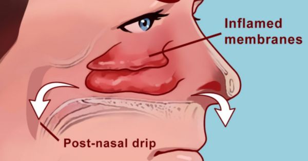 How to Clear Your Sinuses in Seconds with Just Your Fingers