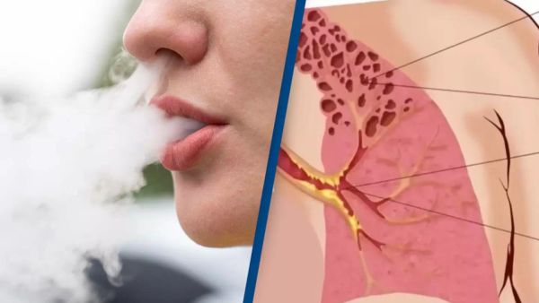 Horrifying simulation shows what really happens to your body when you vape