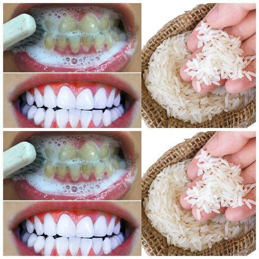 The Fastest Teeth Whitening Trick You Need to Know Now