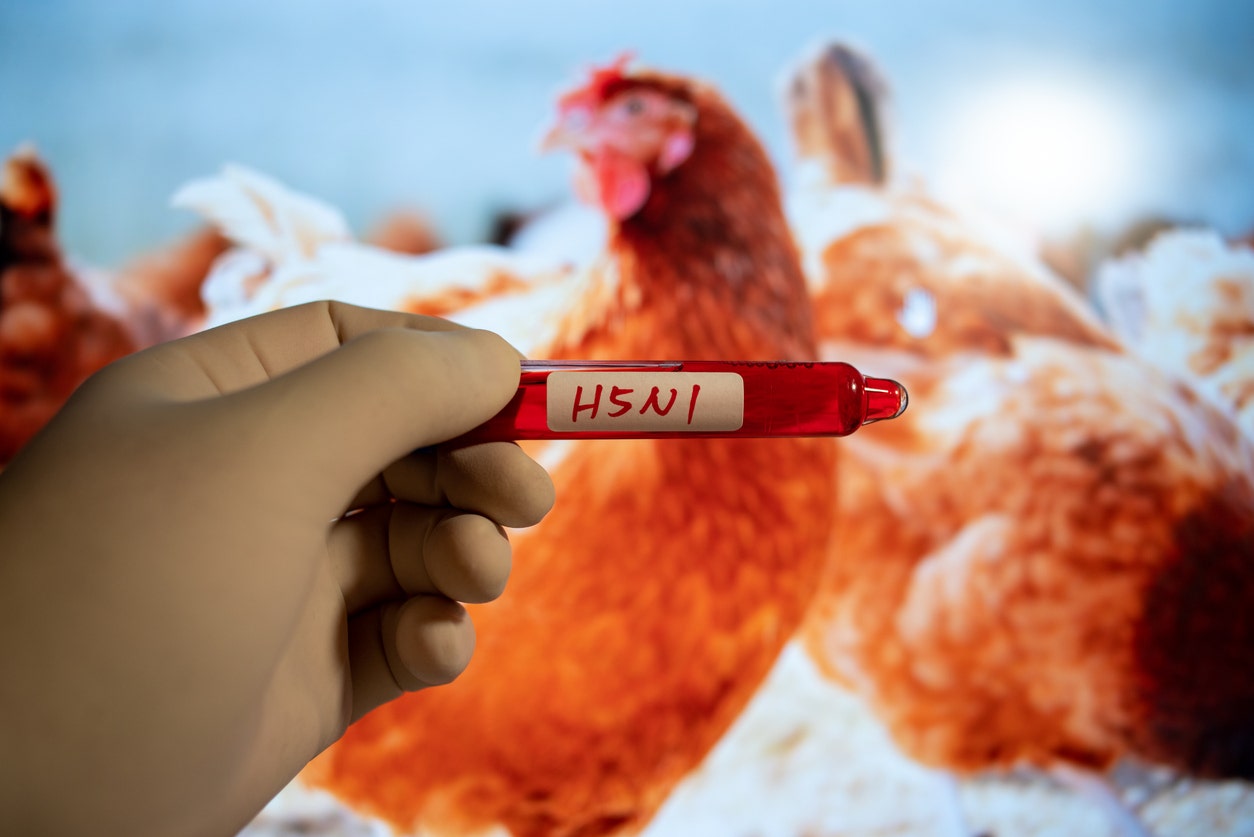 First Case of Human Bird Flu Diagnosed Without Exposure to Infected Animals