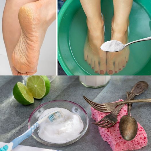 Banish Cracked Heels Forever: The Baking Soda Revolution